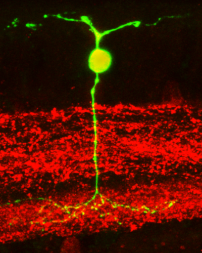 La neurona fue marcada con anticuerpos para detectar presencia de óxido nítrico. En verde colocalización de Lucifer Yellow y Anti nNOS (Créditos: Alex Vielma y Adolfo Agurto, aumento: 60x)