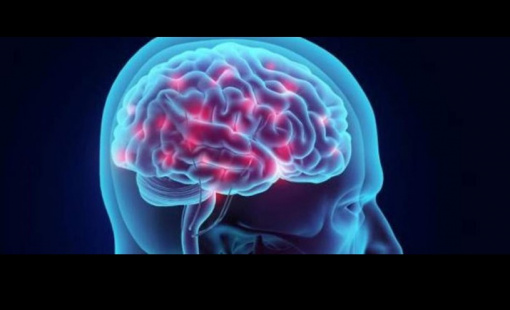 cerebro min cerebro min