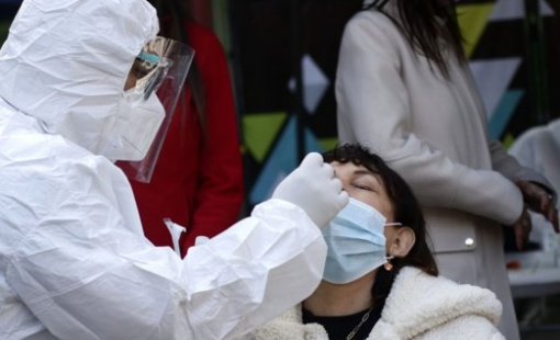 Covid vcerebro min Covid vcerebro min