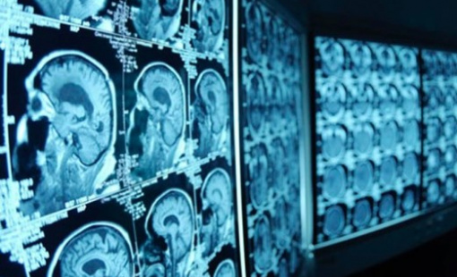 neurociencia-min neurociencia-min