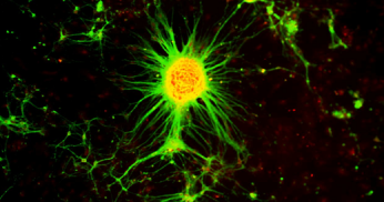 neuroesfera min